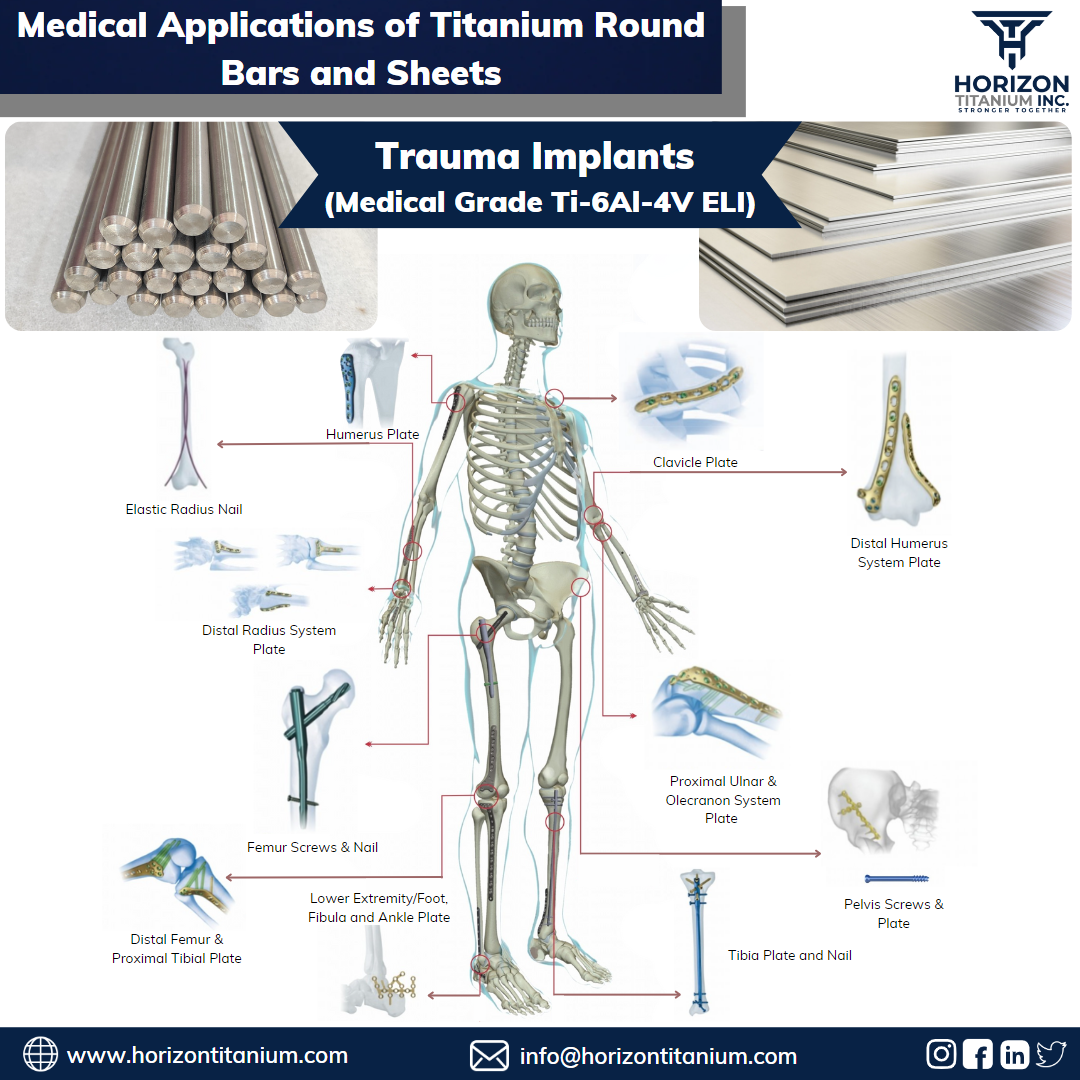 Medical Applications of Titanium Round bars and Sheets (Trauma Implants – Gr. Ti6Al4V ELI)