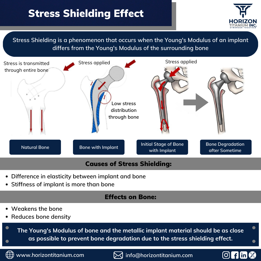 Stress Shielding Effect